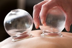 two cups used for cupping on a person's back